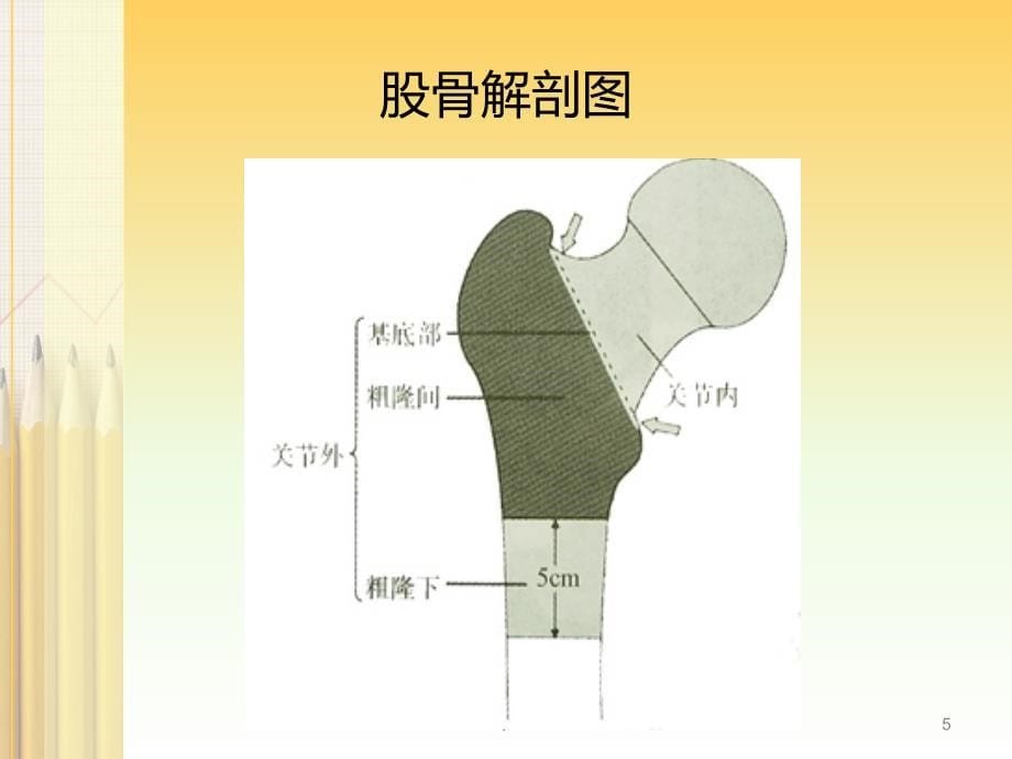 股骨转子间骨折的护理ppt演示课件_第5页