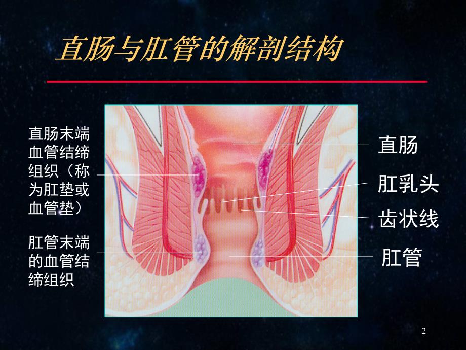 痔疮与套扎治疗课件_第2页