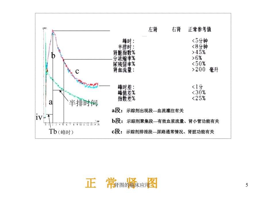 肾图的临床应用课件_第5页