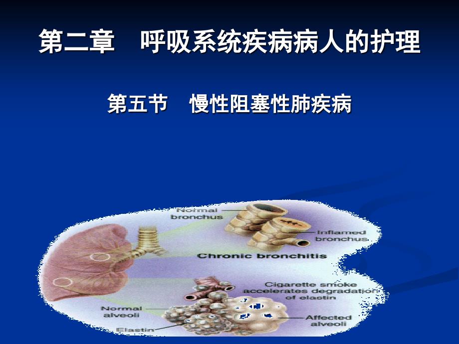 第二章慢性阻塞性肺疾病 ppt课件_第1页