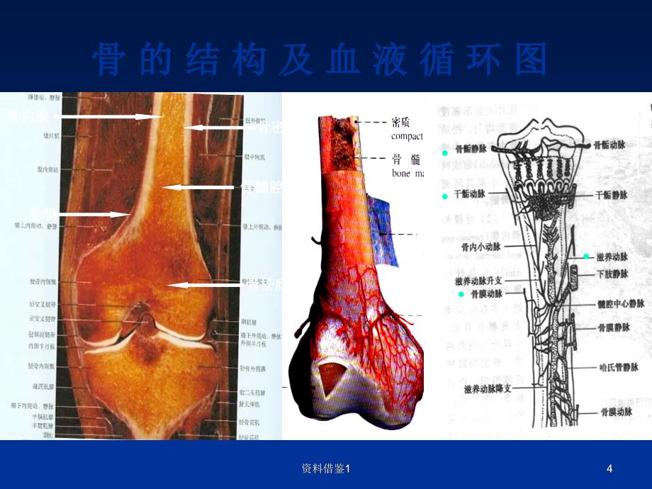 骨关节基本病变--X线表现（行业荟萃）_第4页