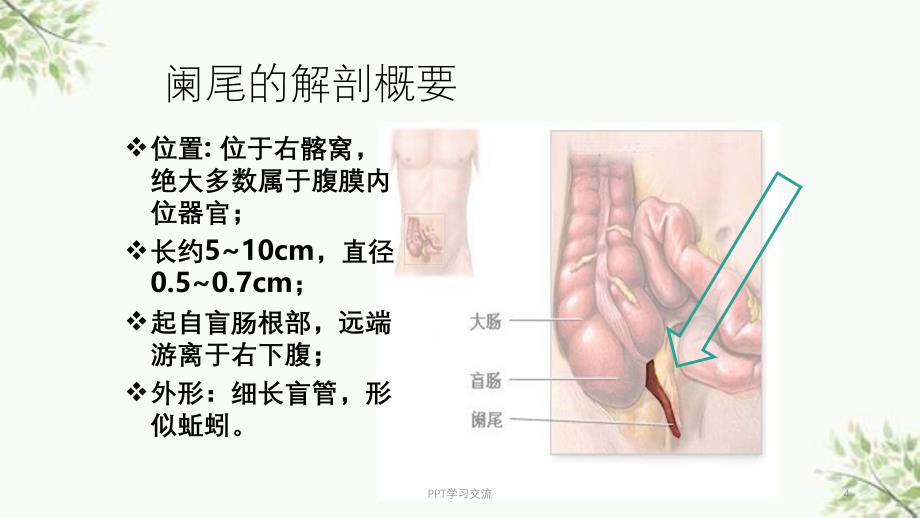 急性阑尾炎护理ppt课件_第4页