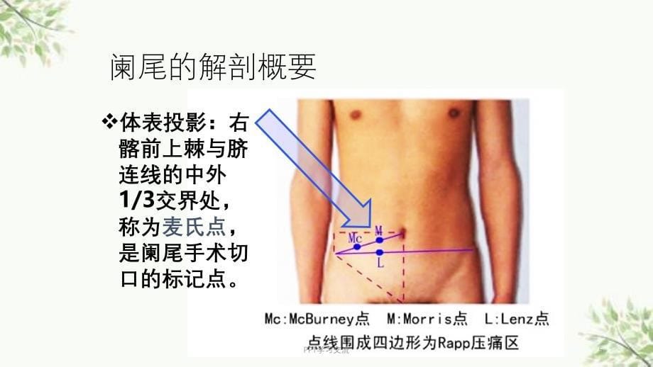 急性阑尾炎护理ppt课件_第5页