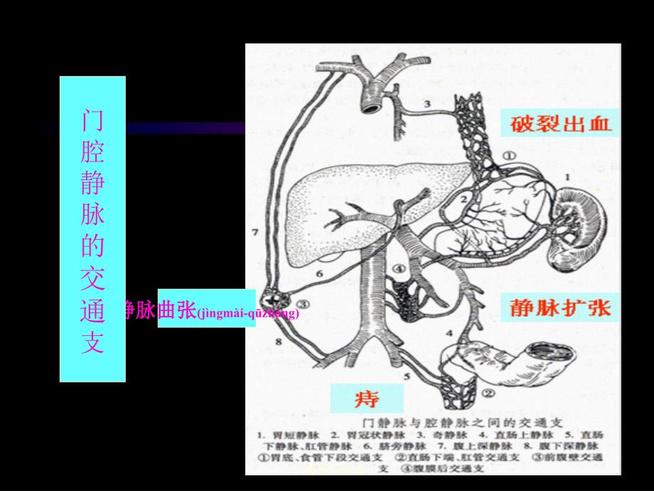 门静脉高压症课件_第4页