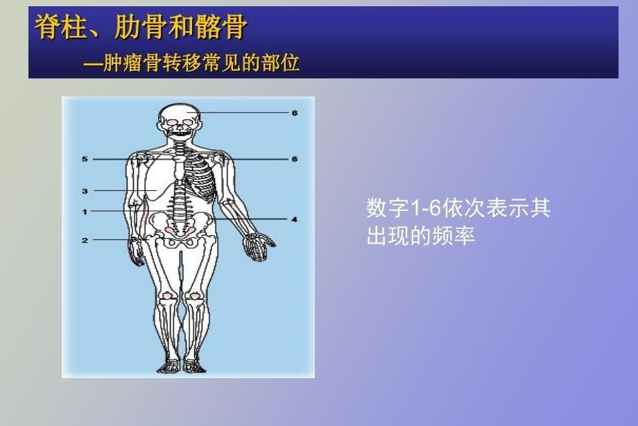 肿瘤骨转移-金尔力_第5页