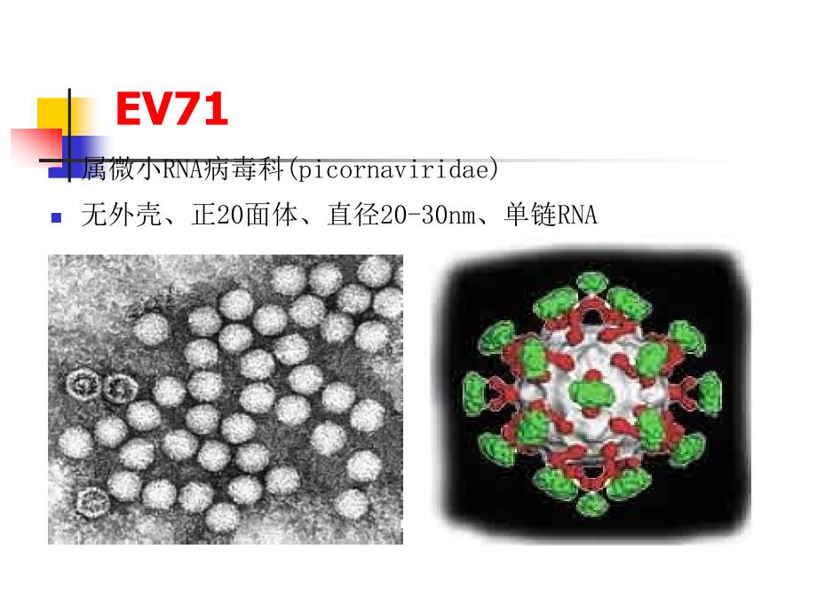 手足口病诊治中的神经系统相关问题(2010-08-30)_第3页