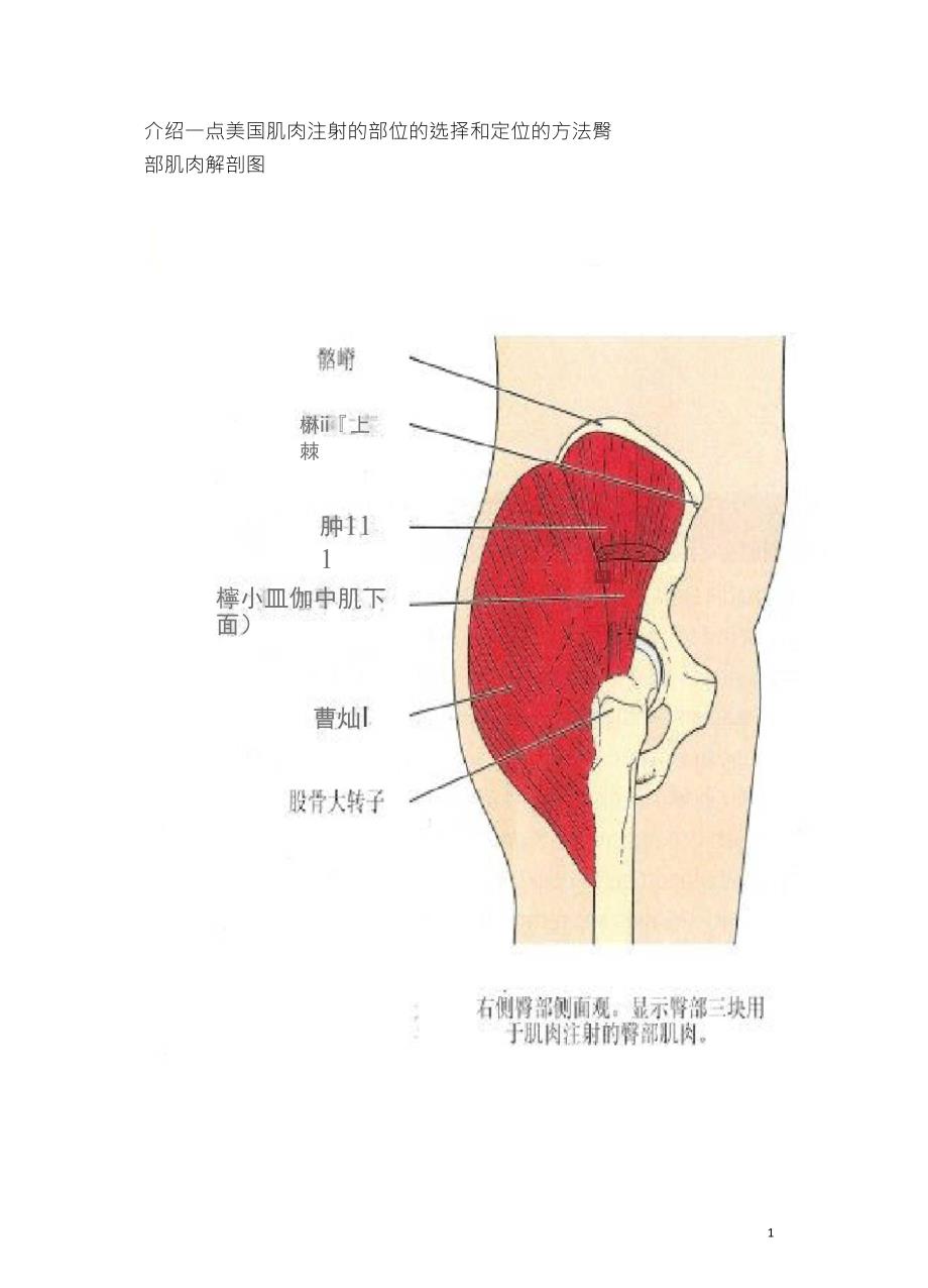 肌肉注射针位置图_第1页