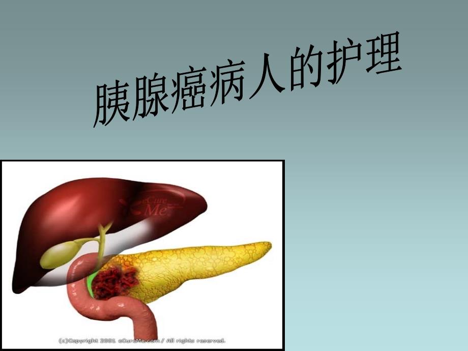 胰腺癌病人的护理_第1页