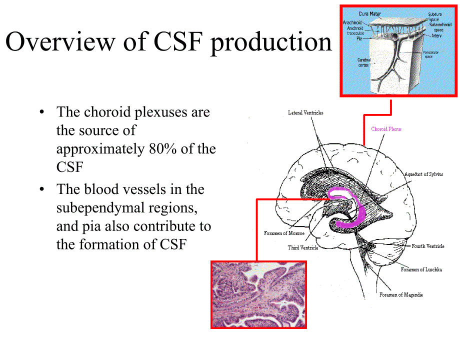 脑积水Hydrocephalus_第3页