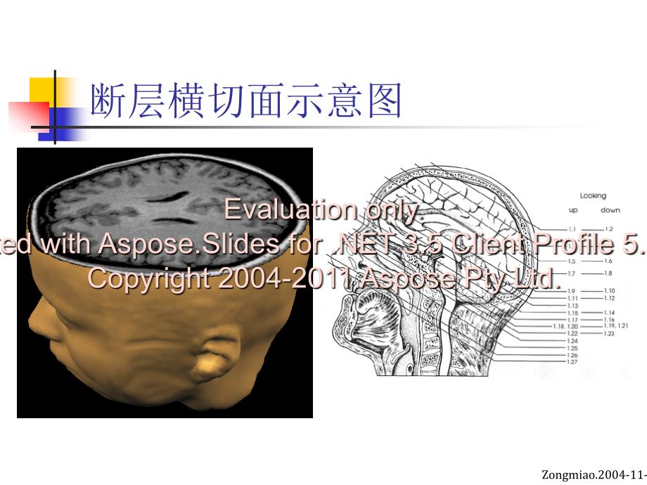 脑磁共振局部解与剖功能图谱_第3页