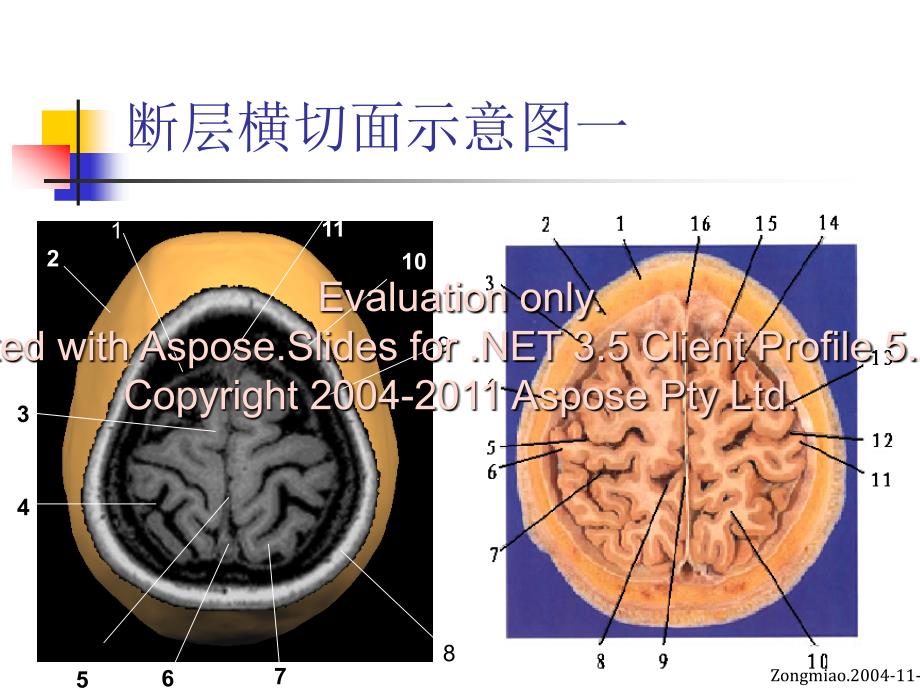 脑磁共振局部解与剖功能图谱_第4页