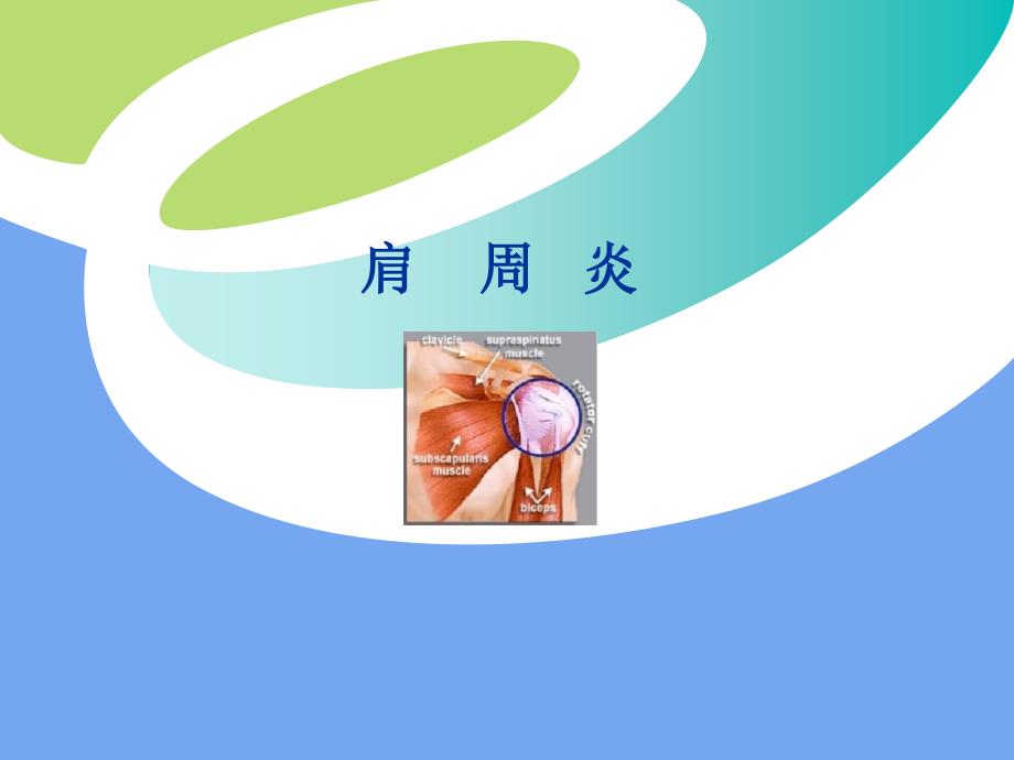 肩周炎精PPT课件_第1页