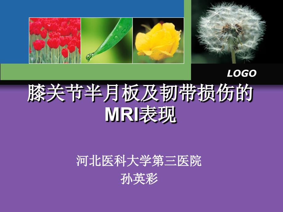 膝关节半月板及韧带损伤的MRI表现_第1页