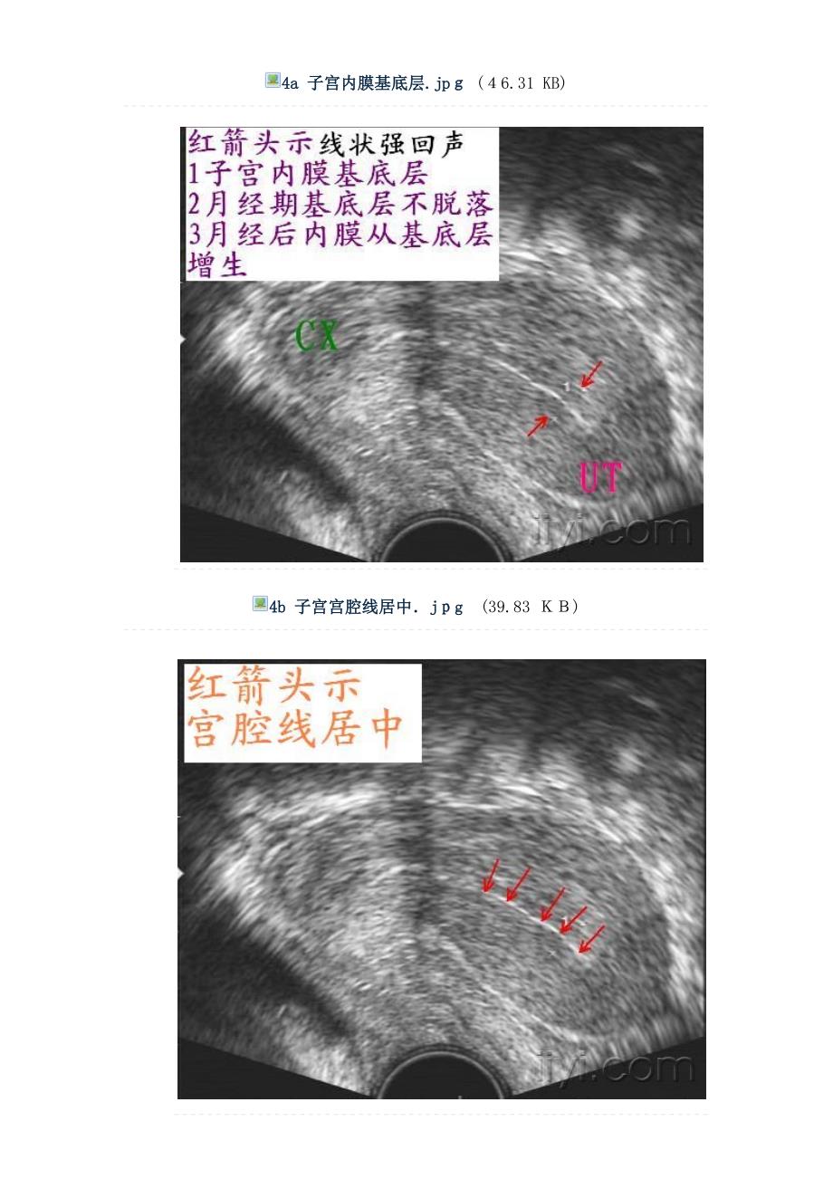 正常子宫和卵巢图片集_第3页