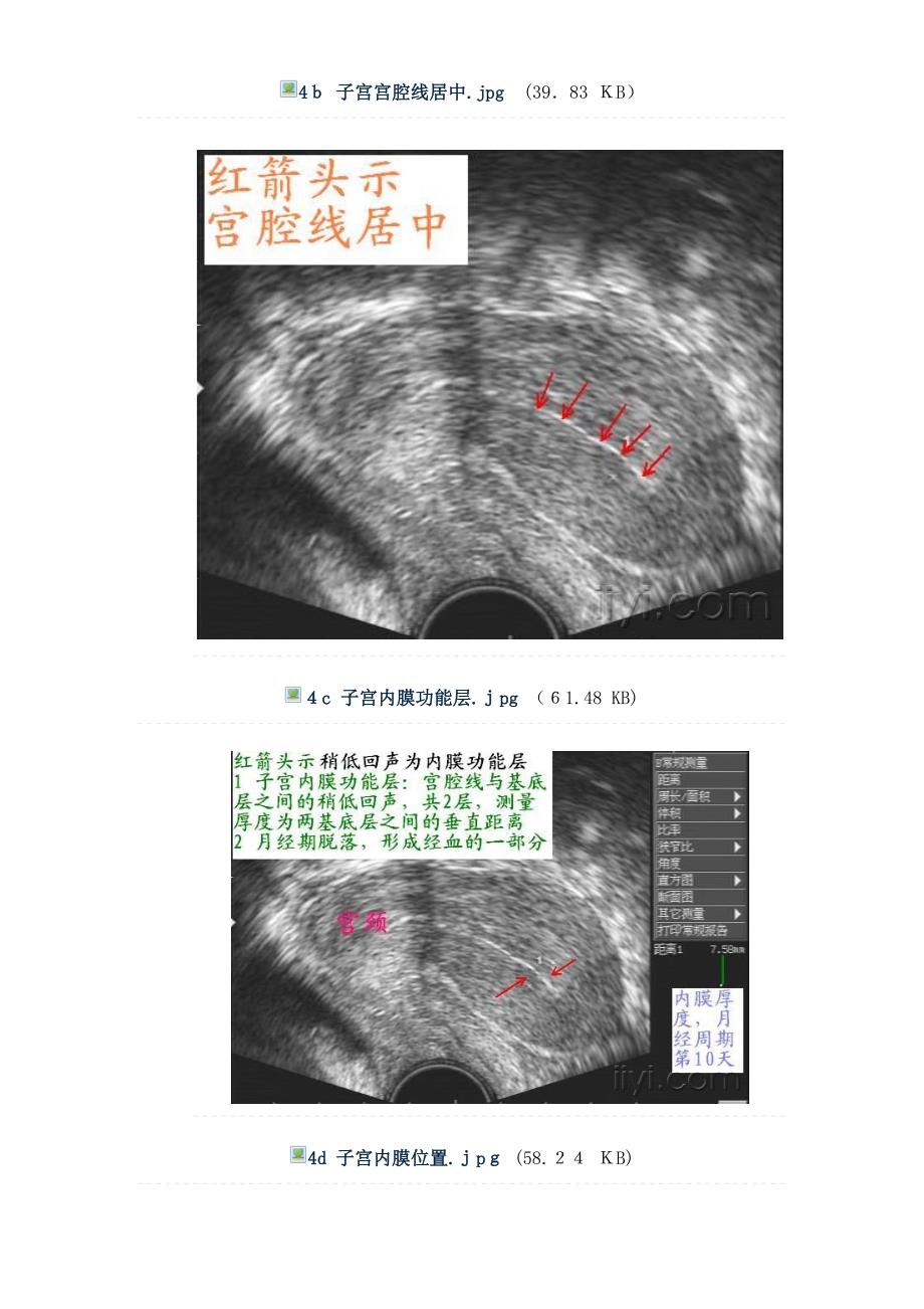 正常子宫和卵巢图片集_第4页