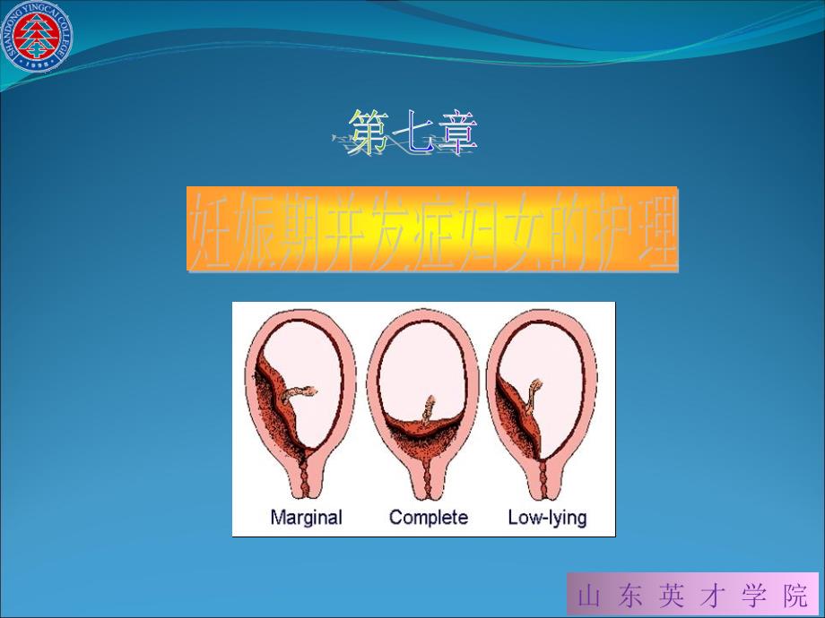 护理系妇产科护理学教学章节件_第1页