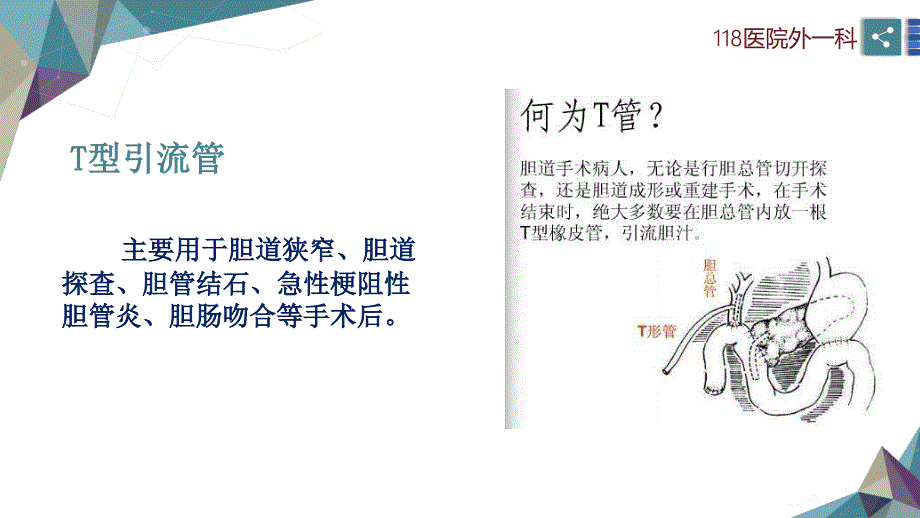 一例胆总管切开取石T管引流术护理查房_第4页