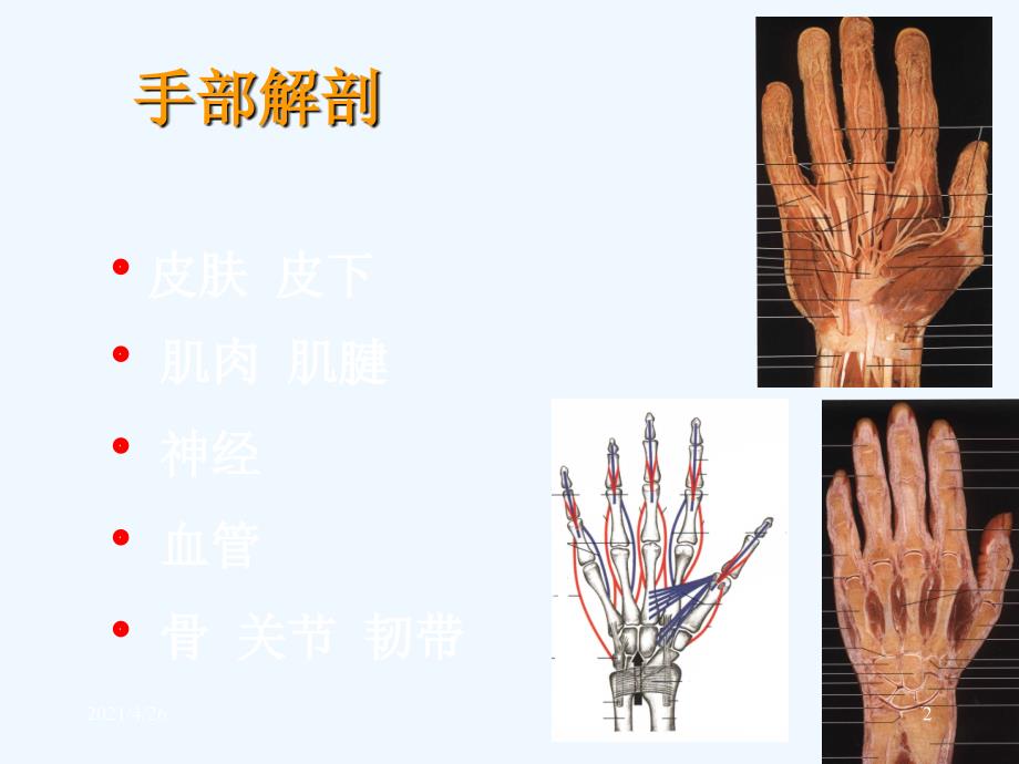 手外伤教学用_第2页