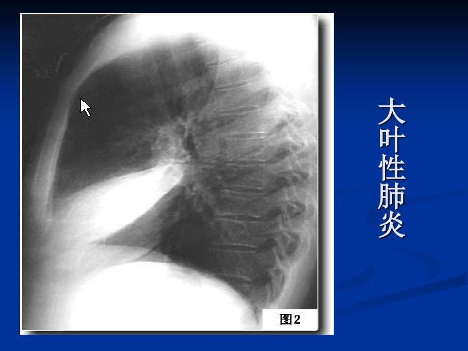 《X线培训》PPT课件.ppt_第5页