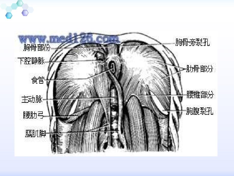 先天性膈疝及其护理课件_第4页