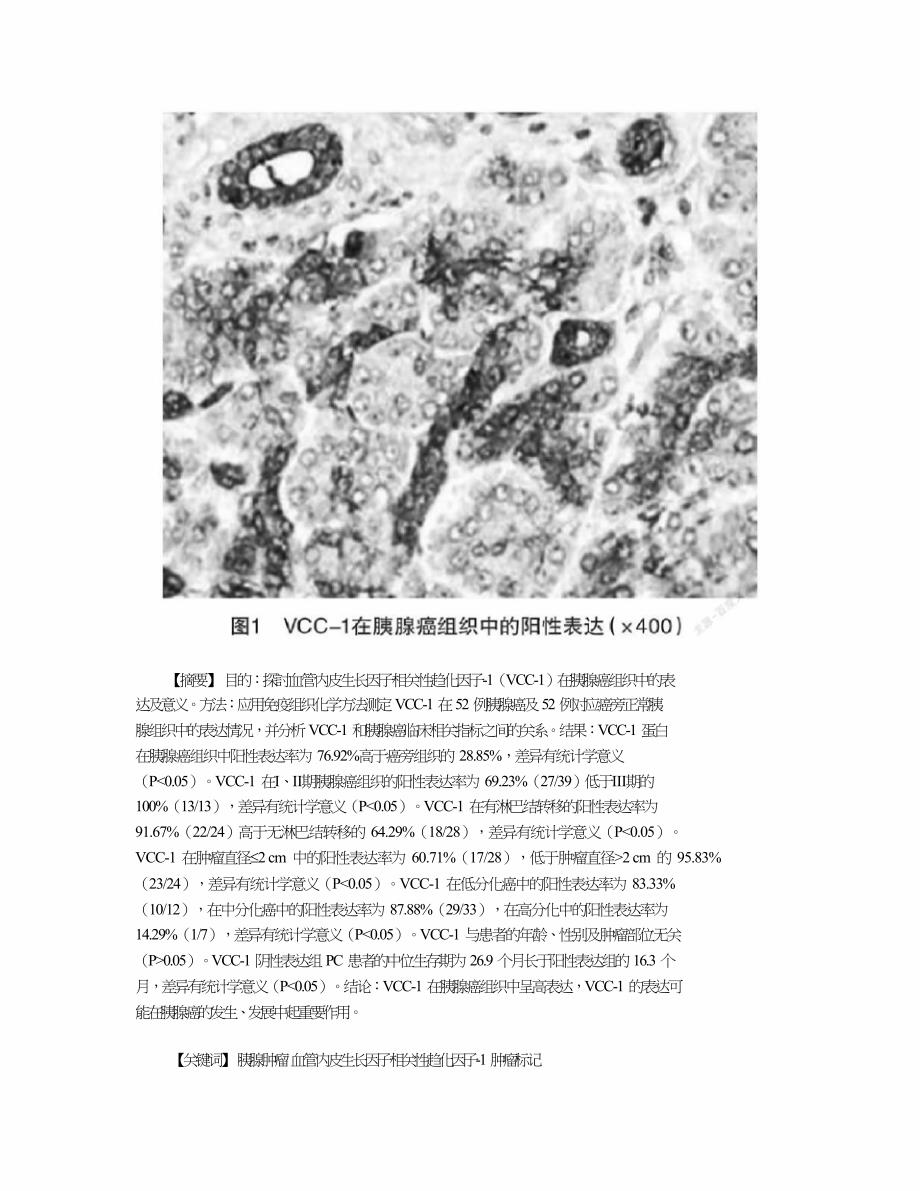 VCC-1在胰腺癌组织中的表达及意义.doc_第3页