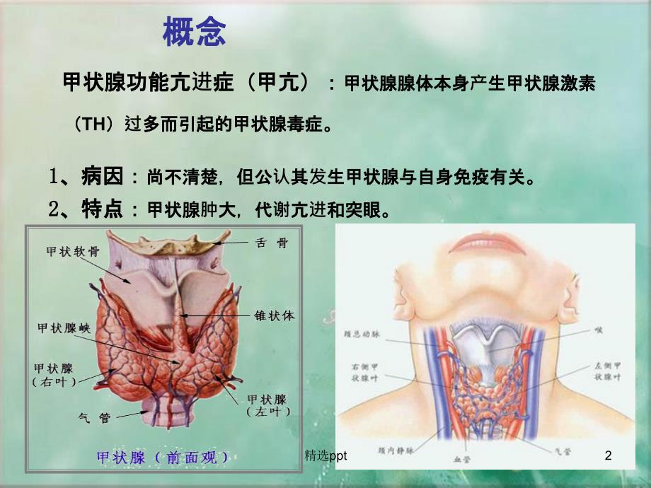 甲状腺功能亢进患者护理查房PPT课件_第2页