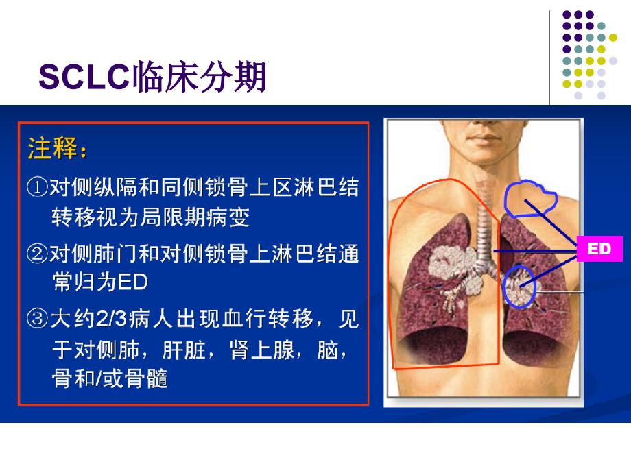 小细胞肺癌2016指南解读_第4页