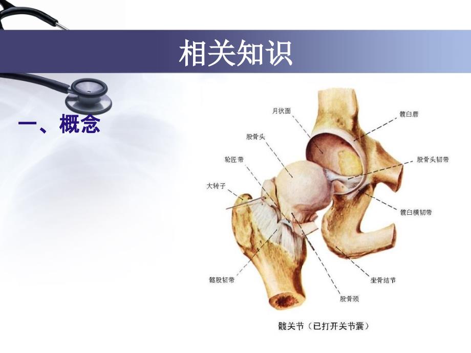 人工全髋关节置换术课件_第3页