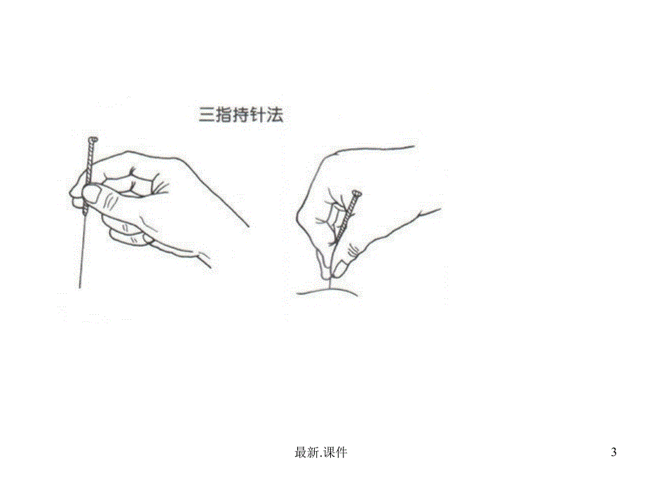 中医适宜技术培训课件报告_第3页