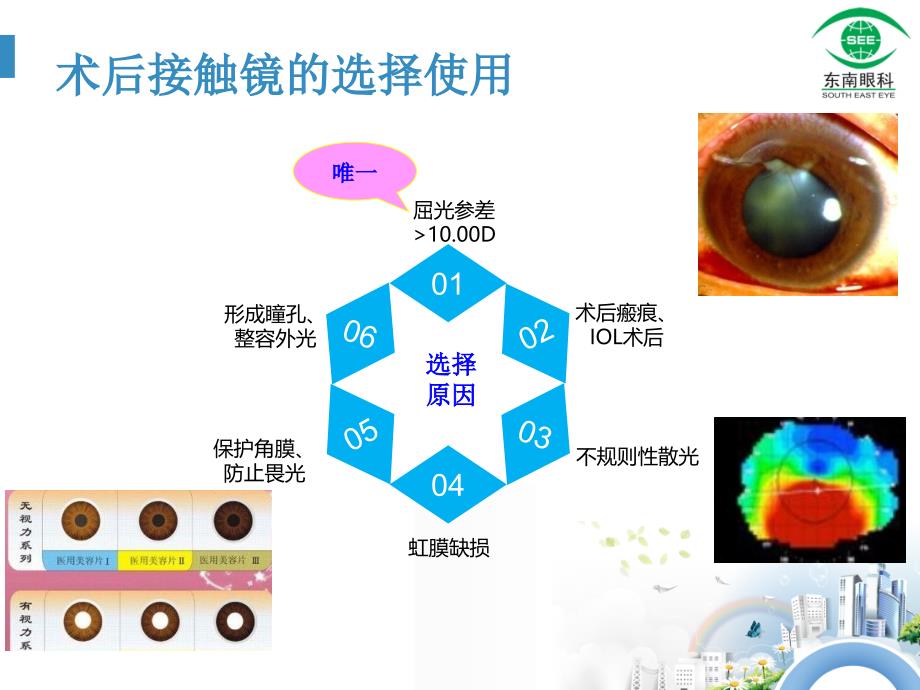 接触镜的特殊应pt课件_第4页