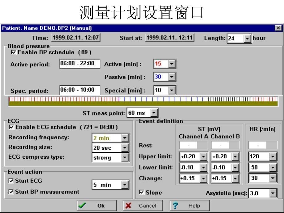 动态血压与动态心电图同步监测的研究应用谭学瑞_第5页