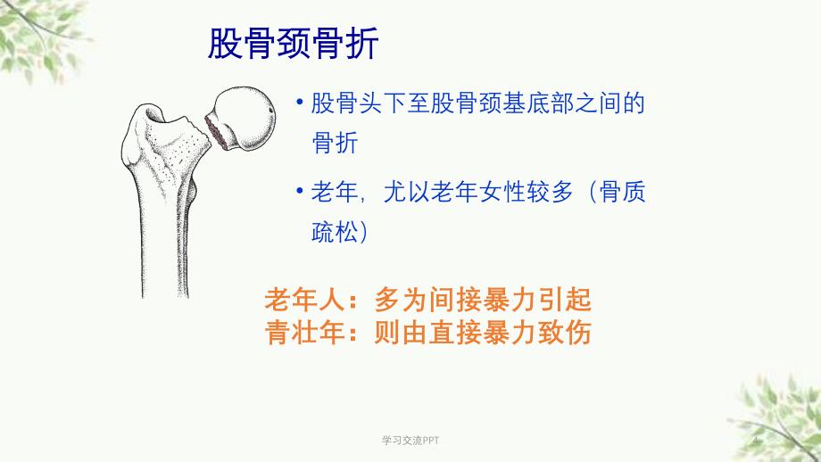 骨科下肢骨折医学课件_第4页