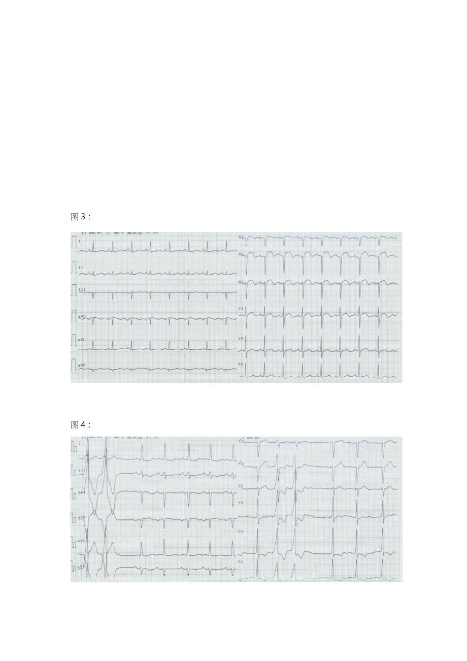 心电图试题(卷)与标准答案解析_第2页