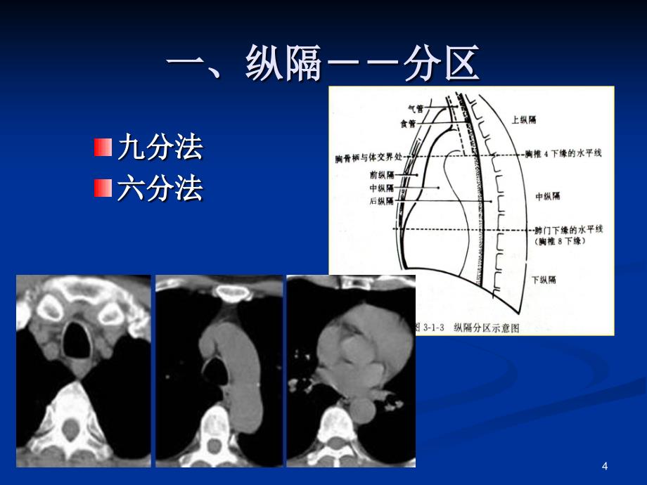 胸部常见疾病CT诊断与鉴别诊断ppt课件_第4页