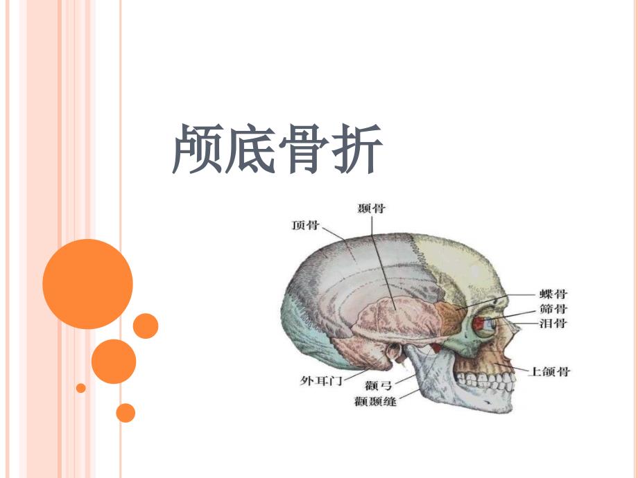 颅底骨折护理标准_第1页