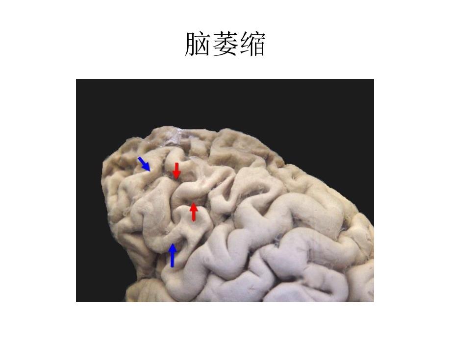 组损与修复医学PPT课件_第2页