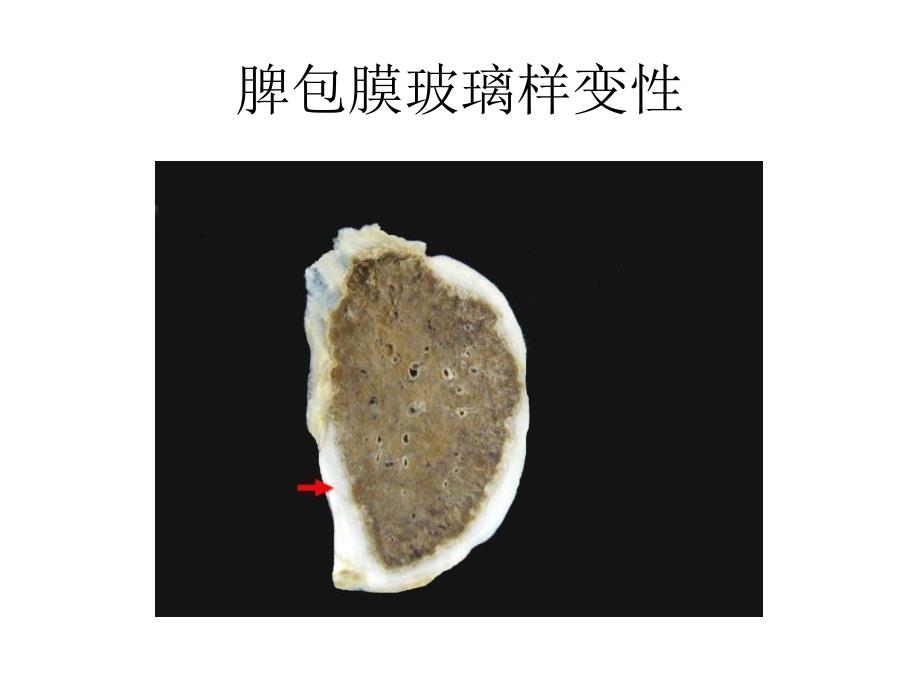 组损与修复医学PPT课件_第4页