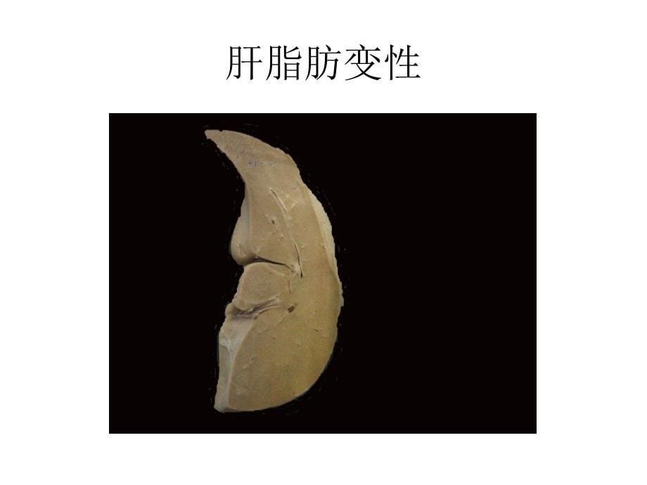 组损与修复医学PPT课件_第5页