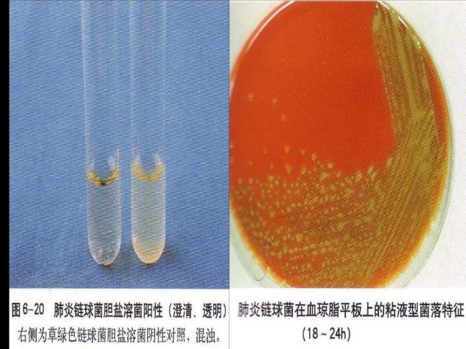 最新医疗肺炎链球菌奈瑟2精品课件_第4页