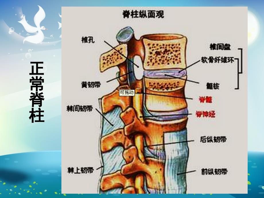 脊柱侧弯围手术期护理ppt课件_第3页