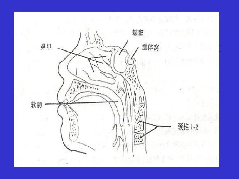 鼻咽癌诊疗常规_第5页