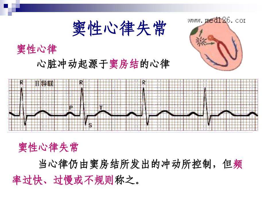 心律失常乔旻_第4页