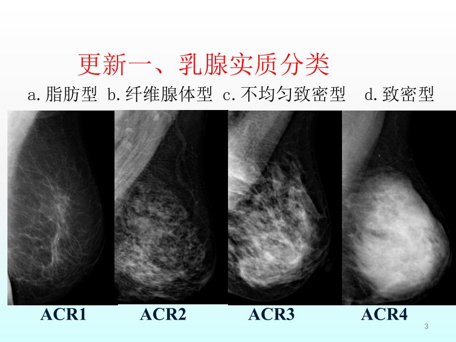 BIRADS分类更新解读乳腺钼靶ppt课件_第3页