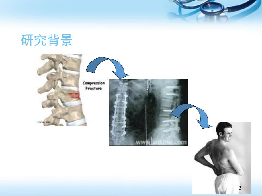 推荐精选经皮椎弓根螺钉内固定术治疗胸腰椎骨折固定_第2页