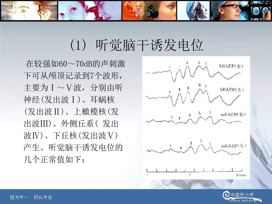 脑干诱发电位(ABR)的简介_第4页