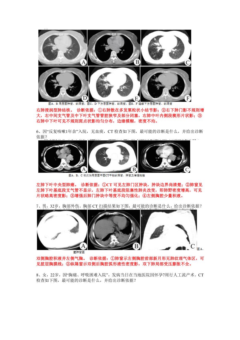 南方医科大学影像学精品课程试题(呼吸系统).doc_第4页