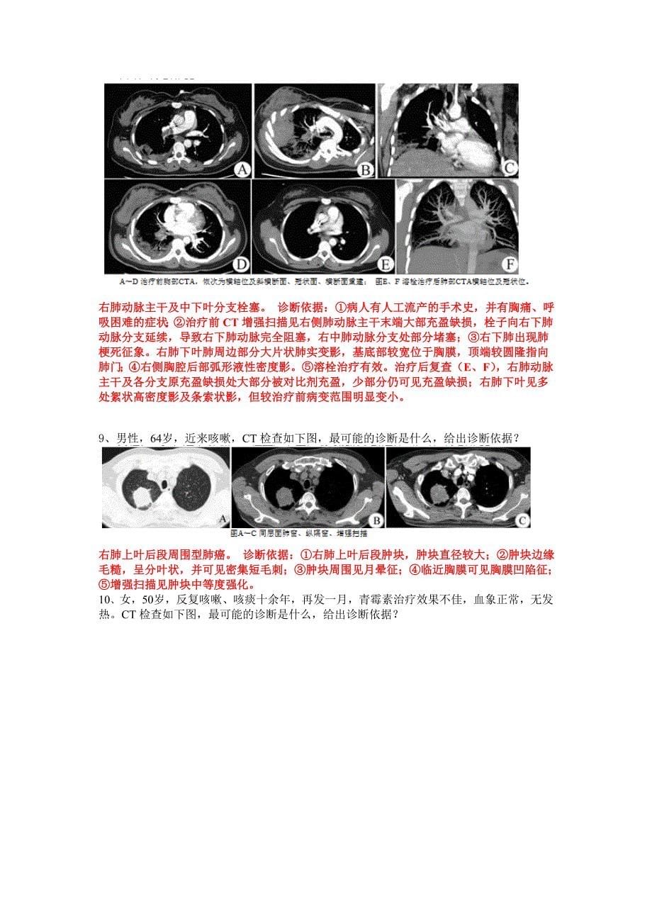 南方医科大学影像学精品课程试题(呼吸系统).doc_第5页