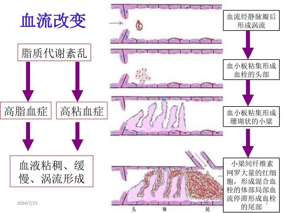 抗血小板药与临床监测ppt参考课件_第5页