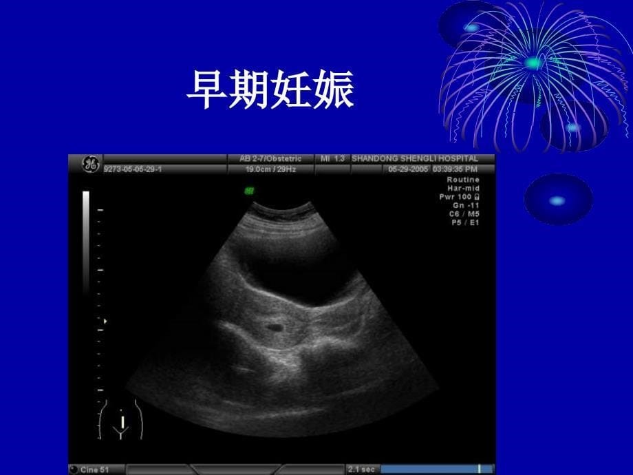 易导致医疗事故超声报告的书写于国放山东.ppt_第5页