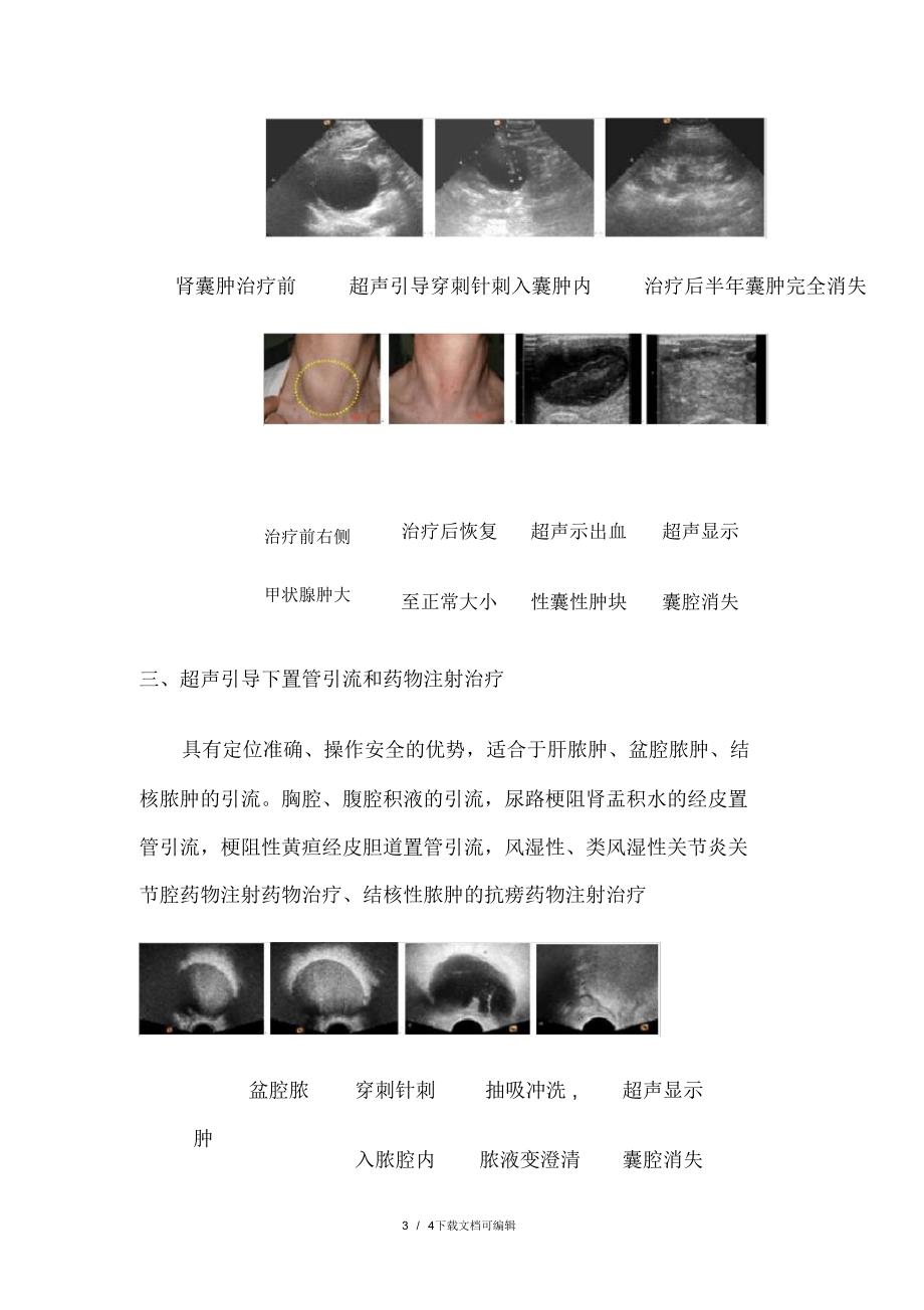 超声引导下的穿刺活检和介入治疗_第3页